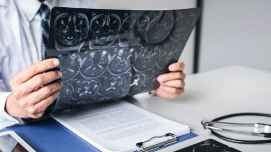 Improving outcomes for brain cancer patients