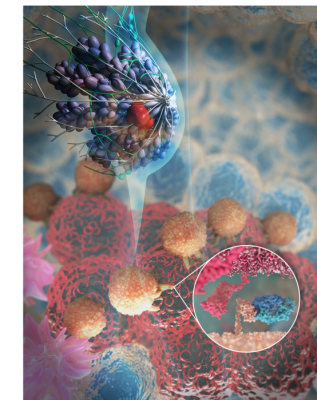 Researchers uncover how patients with breast cancer respond to immunotherapy treatment