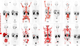 Prostate cancer imaging paper wins Best Scientific Paper of 2021
