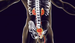 Game-changing prostate cancer scan available through Medicare from July 1